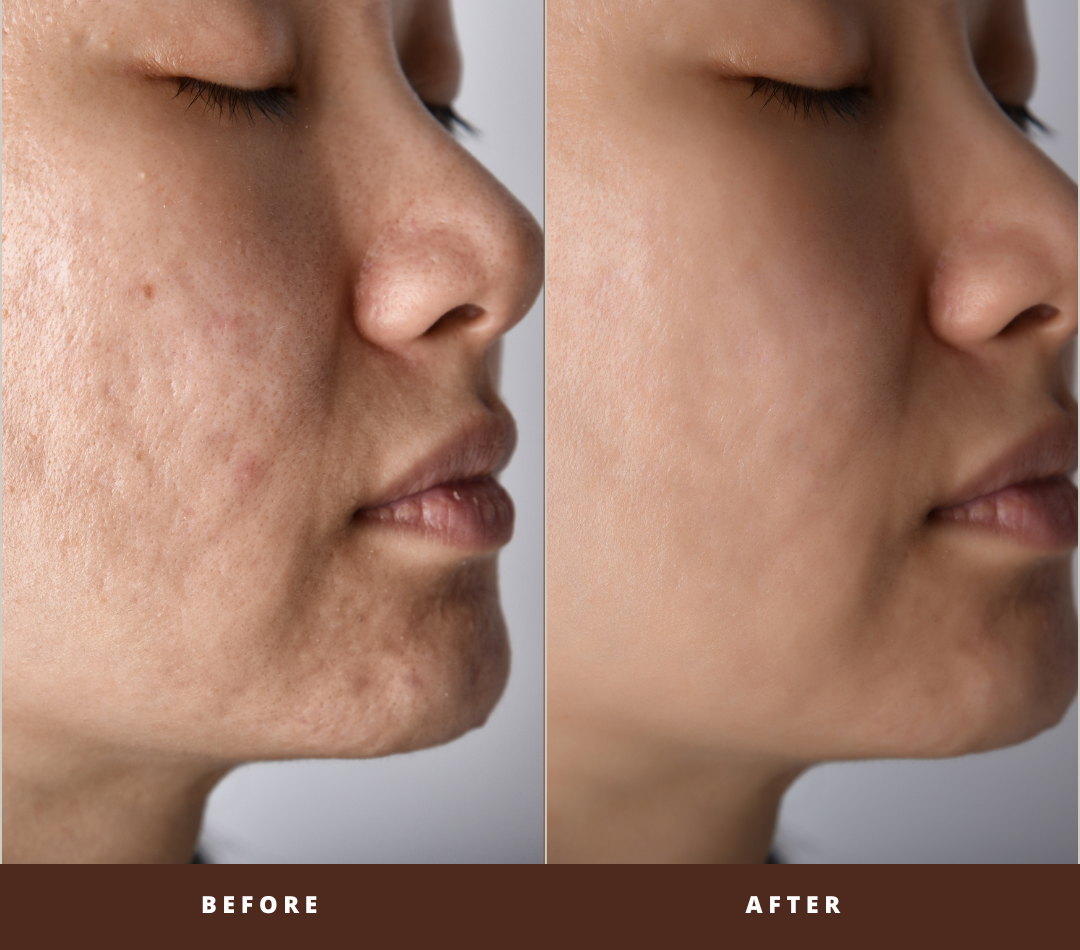 GlowWithin™ LED Face Mask